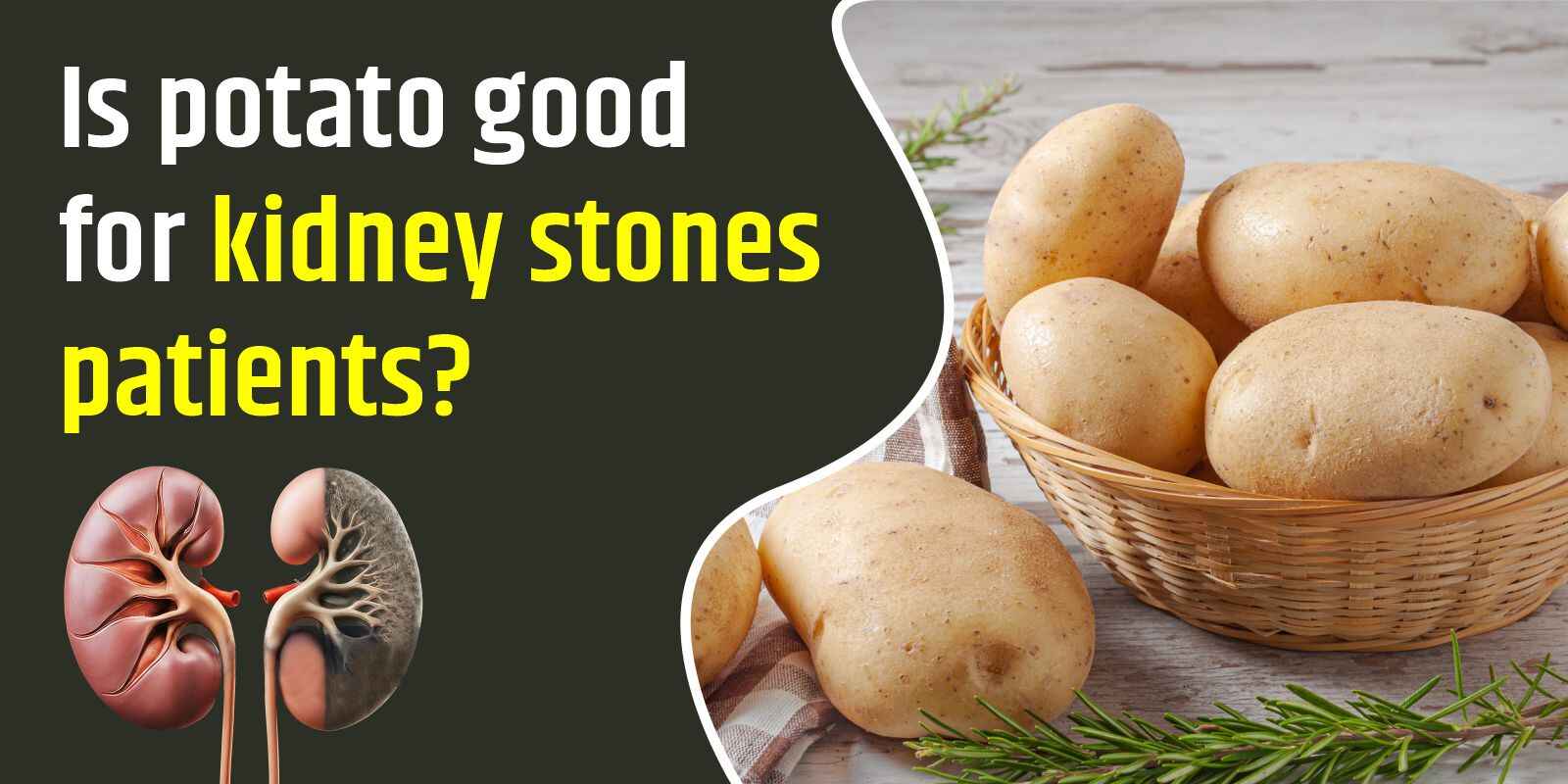 Is Potato Good for Kidney Stones Patients?